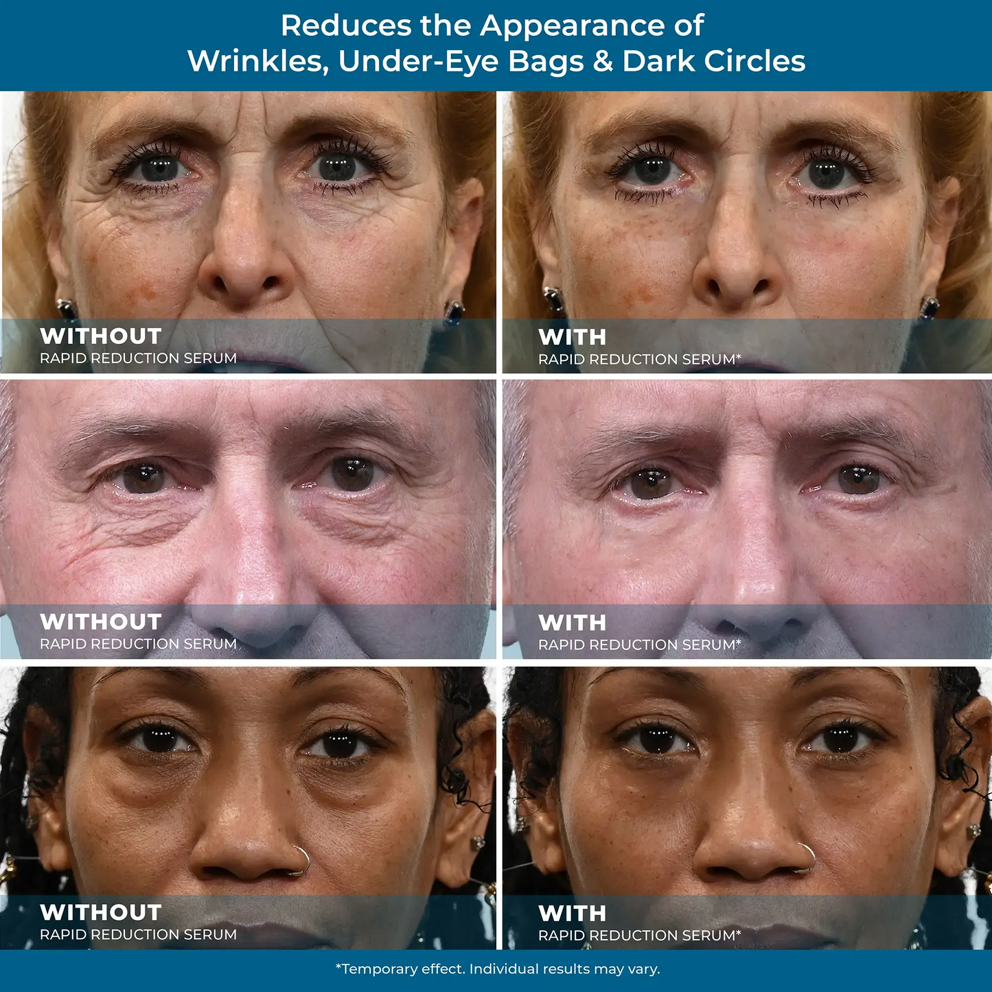 Rapid Reduction Serum - 1-Month Supply