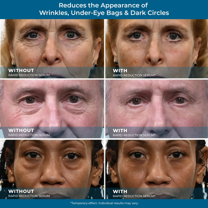 Rapid Reduction Serum - 1-Month Supply