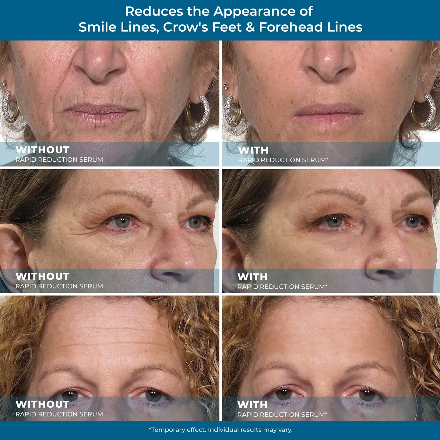 Rapid Reduction Serum - 1-Month Supply